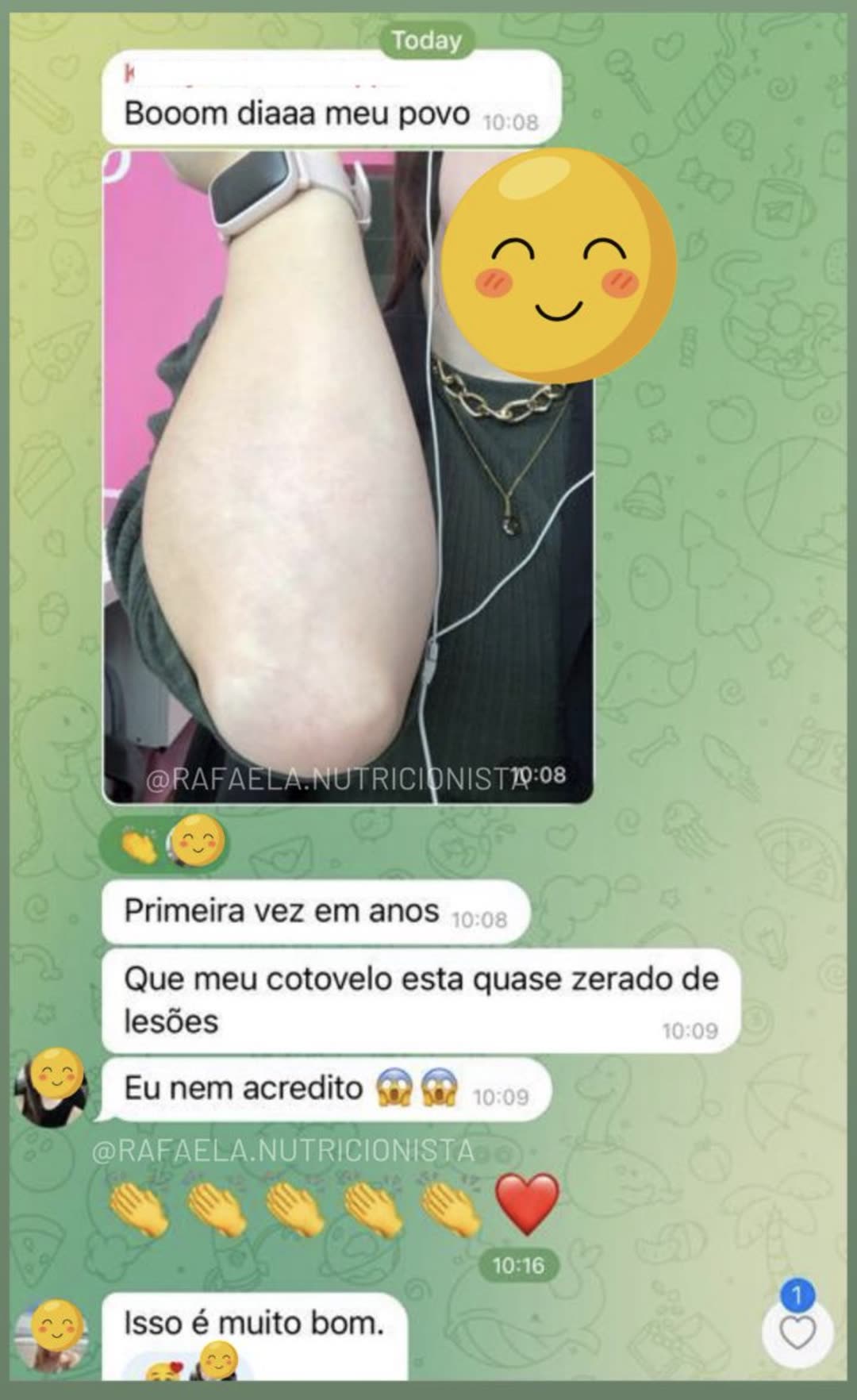 Relato: cotovelo sem lesões pela primeira vez em anos