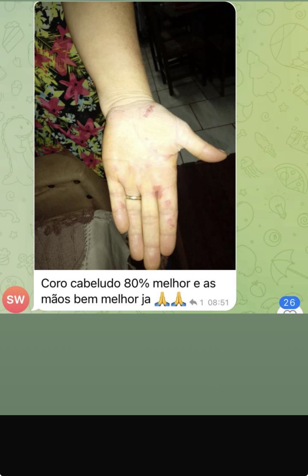Relato: couro cabeludo 80% melhor e mãos melhores