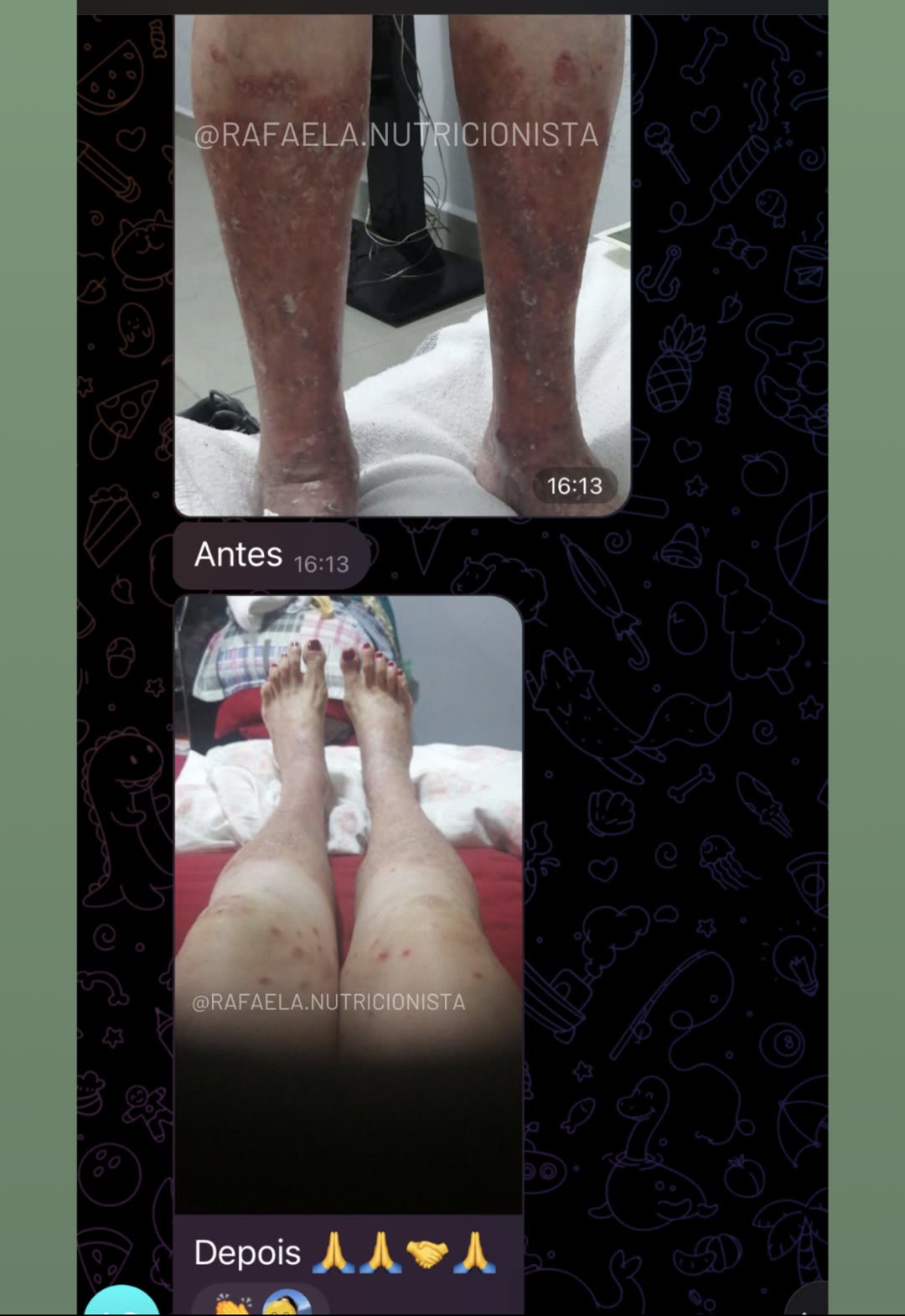 Relato: pernas antes e depois